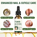 7 days Nail Treatment Serum(Pack of 2)