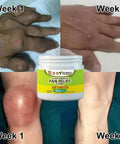 Bee Venom Pain Relief Cream