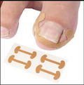 Nail Correction Patches (Pack of 4)
